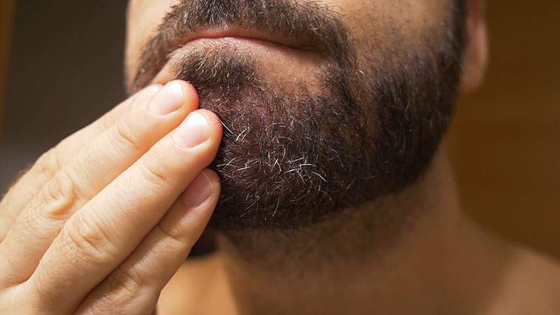Man scratching his chin under the beard