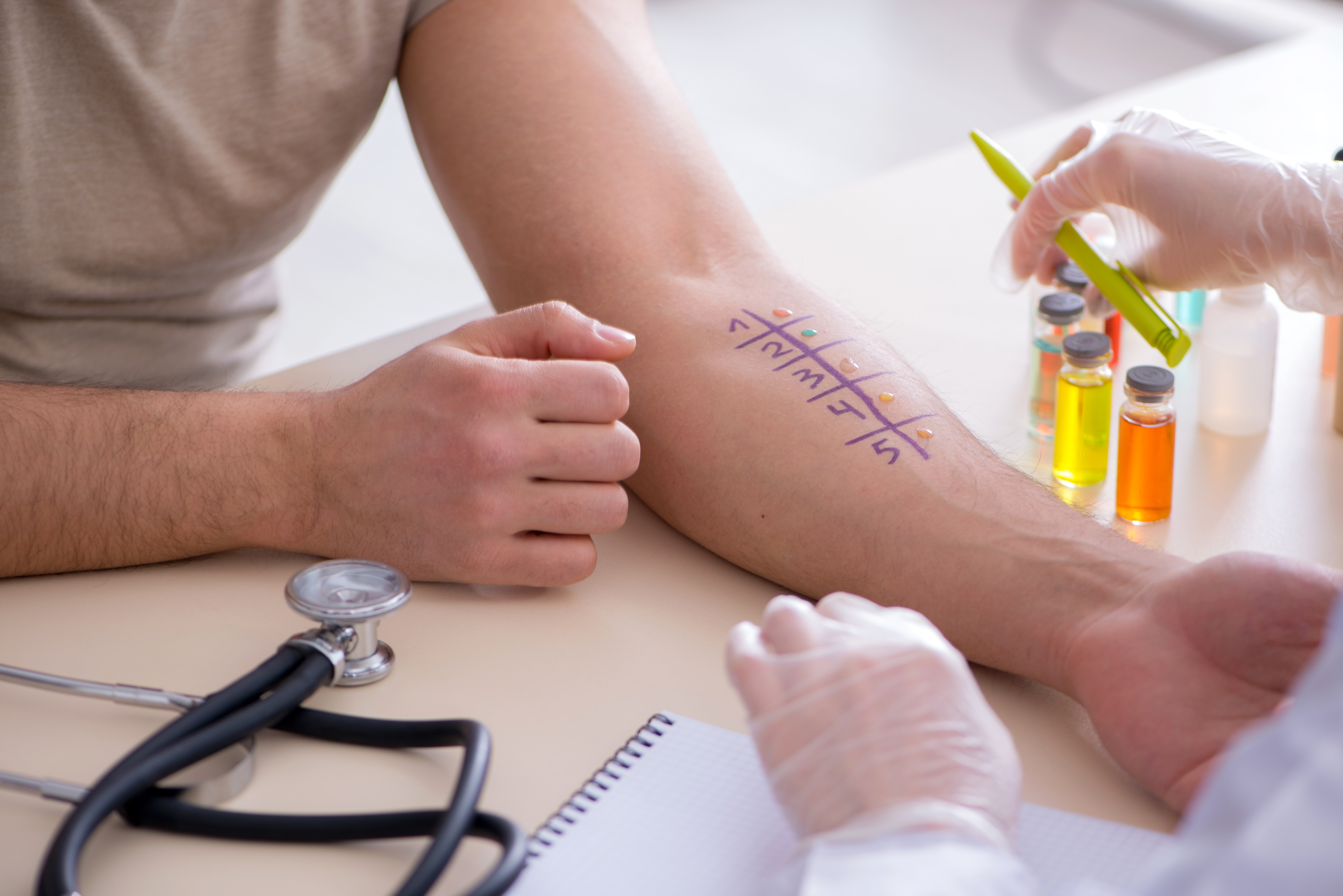 Man arm testing allergic reaction